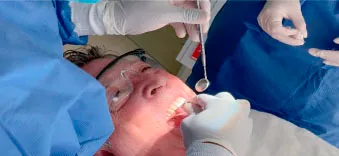 Step 4 of All-on-4 treatment in Mexico, detailing the attachment of high-quality dental prosthetics.