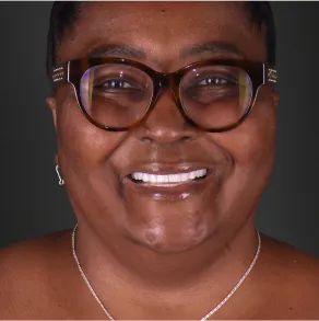 Reliable dental implant services in Mexico for long-lasting and natural smile restoration